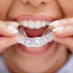 from grind to shine expert tips for managing bruxism